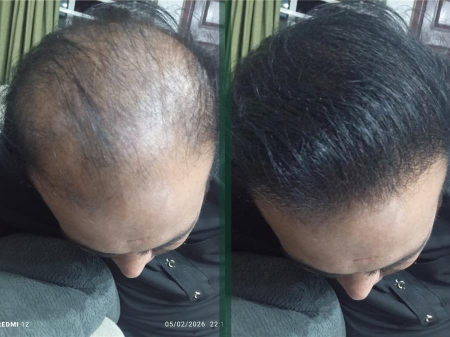 Medium hair result